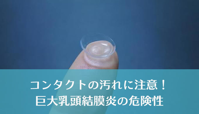 花粉症じゃなくて「巨大乳頭結膜炎」かも！ コンタクトレンズの汚れが引き起こす結膜炎の正体とは