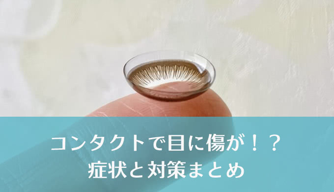 知らなきゃ危険！コンタクトで起こりうる目の傷と症状、その治療法